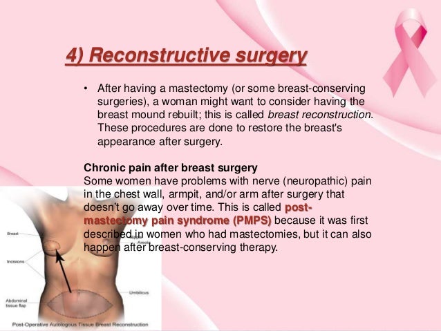 chemotherapy after breast cancer Laura posada tits